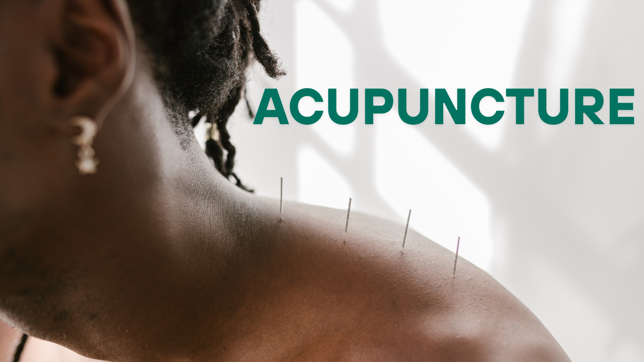 acupuncture